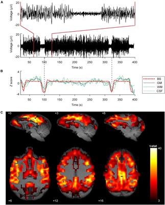 Isoflurane-Induced Burst Suppression Increases Intrinsic Functional Connectivity of the Monkey Brain